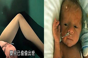 孕婦陣痛36小時 剖腹時竟不見寶寶 醫生和媽媽都嚇壞了