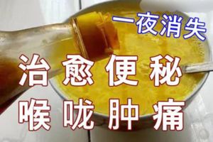 一些食療偏方完全可以治癒便秘喉嚨腫痛一夜消失