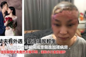 丈夫有外遇，，元配氣得燒炭成自焚！毀容慘住ICU渣男甜牽小三拍婚紗