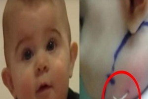 媽媽發現7個月大的寶寶臉頰上突然長了一根「白色尖角」！摸起來還硬硬的！送去醫院檢查...發現「真相」竟是...聽得她心臟差點停止！