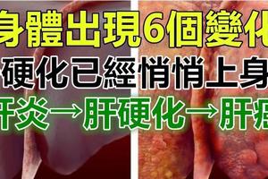 身體出現6個變化，「肝硬化」已經悄悄上身了！肝癌不痛不癢，發現已經是晚期，早期癥兆要注意！     ※※※※ 歡迎分享出...