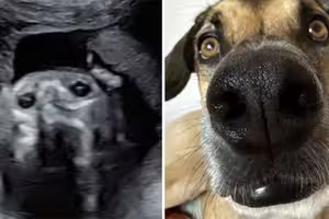 新手媽做產檢 一看「兒子超音波照」愣了:和愛犬長一模一樣 新手媽做產檢 一看「兒子超音波照」愣了:和愛犬長一模一樣