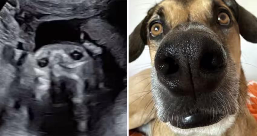 新手媽做產檢　一看「兒子超音波照」愣了：和愛犬長一模一樣