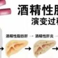 肝不好，百病生！專家教您巧用「三味」中藥，對症養肝！