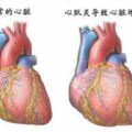 29歲女子感冒後心跳只有25次/分，經搶救51小時仍無力回天！