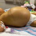 新生女嬰「肚子膨脹似氣球」，醫生檢查後發現竟是「這個原因」，最後…