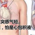 女人突感氣短、胸痛，怕是心包積液，需多吃這類食物