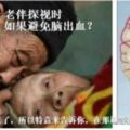 72歲腦出血，老伴探視時讓醫生淚流。如果避免腦出血？