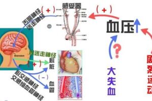 中風的元兇原來是「頸椎」，中風的患者部分經過及時的治療後遺症可以完全消除