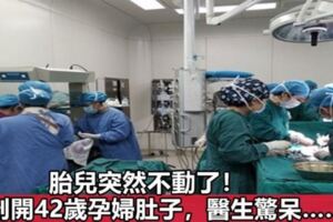 胎兒突然不動了！剖開42歲第三胎孕婦肚子，醫生不淡定了