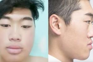 韓國男生也愛上了整形「甚至要比女生更美」，揭秘雙眼皮尖下巴的整形過程讓外國人超震撼啊！